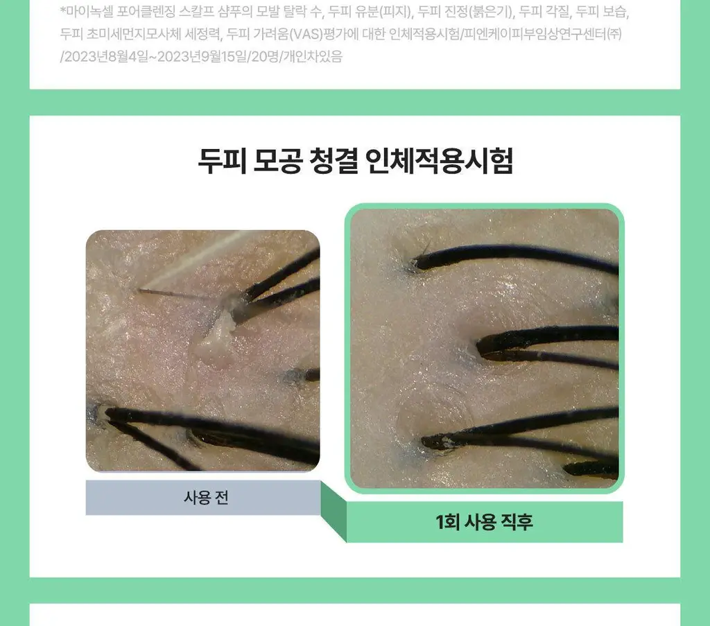 [허경환 PICK/현대약품특허]마이녹셀 포어클렌징 스칼프 샴푸 480ml 상세페이지 17